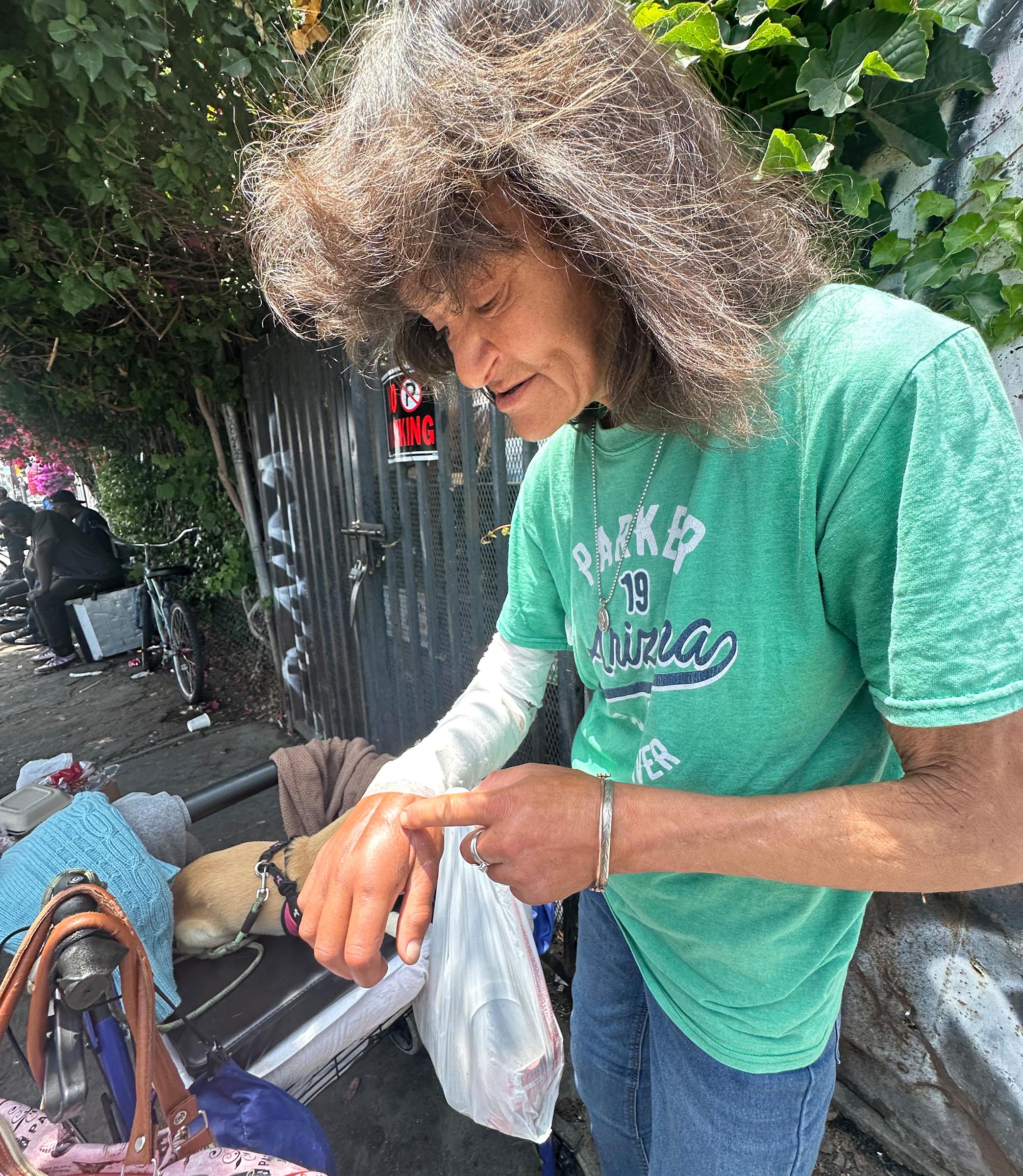 Cindy Ashley recovers from surgery on her hand and arm...